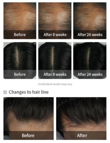 Cabello al mejor precio: La'dor Dermatical Hair-Loss Shampoo - Champú Anticaida de Lador Eco Professional en Skin Thinks - 