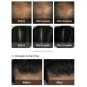 Cabello al mejor precio: La'dor Dermatical Hair-Loss Shampoo - Champú Anticaida de Lador Eco Professional en Skin Thinks - 