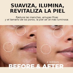 Emulsiones y Cremas al mejor precio: Its Skin RetinoidiN Cream 100ml de It´s Skin en Skin Thinks - Piel Seca