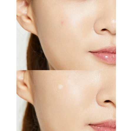 Cosmética Coreana al mejor precio: Parche Anti Acné COSRX Acne Pimple Master Patch de Cosrx en Skin Thinks - Piel Grasa