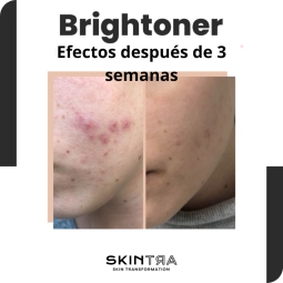 Tónicos - Cosmética Natural al mejor precio: Tónico Exfoliante Iluminador SkinTra Brightoner de SKINTRA en Skin Thinks - Tratamiento de Poros