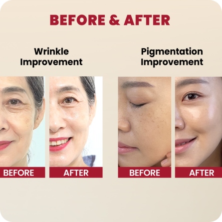 Cosmética Coreana al mejor precio: Seoul 1988 Serum: Retinal Liposome 2% + Black Ginseng de K-Secret en Skin Thinks - Piel Seca