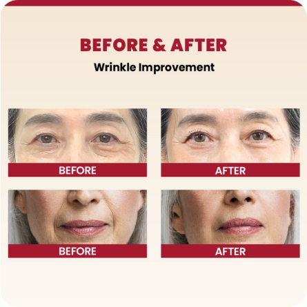 Emulsiones y Cremas al mejor precio: Seoul 1988 Cream: Retinal Liposome 1% + Fermented Rice de K-Secret en Skin Thinks - Piel Seca