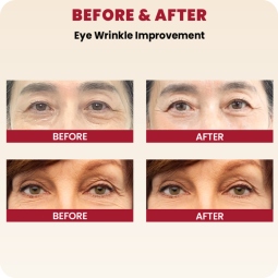 Contorno de Ojos al mejor precio: Seoul 1988 Eye Cream: Retinal Liposome 4% + Fermented Bean de K-Secret en Skin Thinks - Tratamiento Anti-Edad