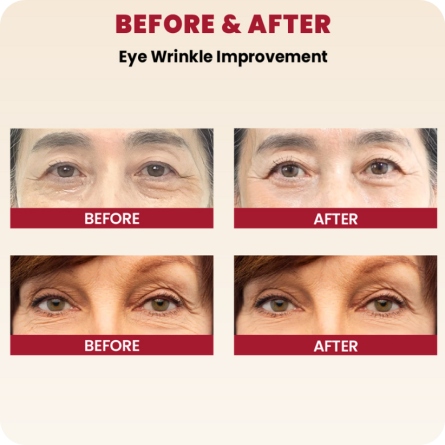 Contorno de Ojos al mejor precio: Seoul 1988 Eye Cream: Retinal Liposome 4% + Fermented Bean de K-Secret en Skin Thinks - Piel Seca