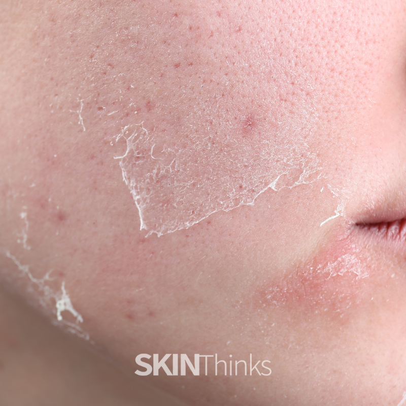 ¡No, tu piel no necesita medio bote de retinal! 3 Skin Thinks, tienda online de cosmética coreana, natural y vegana